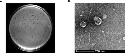 Isolation and characterization of a novel mycobacteriophage Kashi-VT1 infecting Mycobacterium species